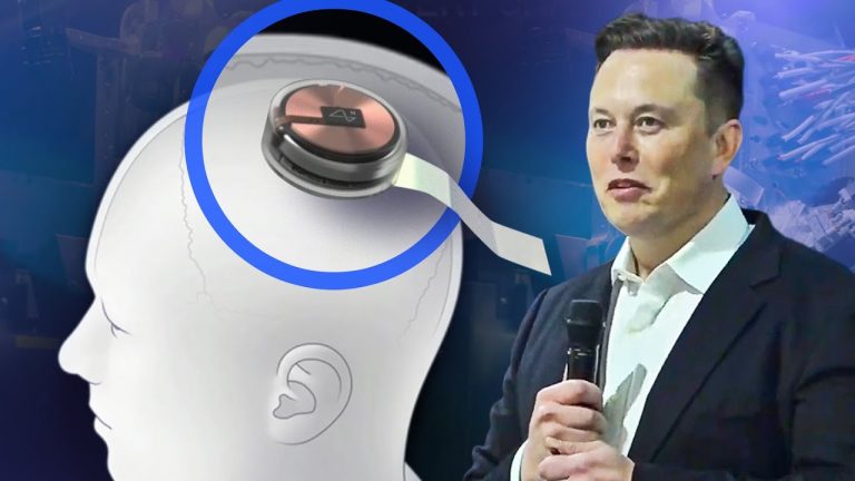 Elon Musk Siap Tanamkan Chip ke Otak Manusia, Mirip Serial 'Black Mirror'